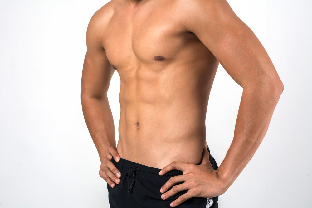 gynecomastia 1