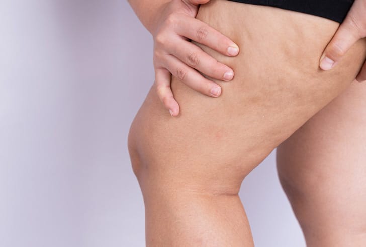 The Avéli Procedure Step-by-Step