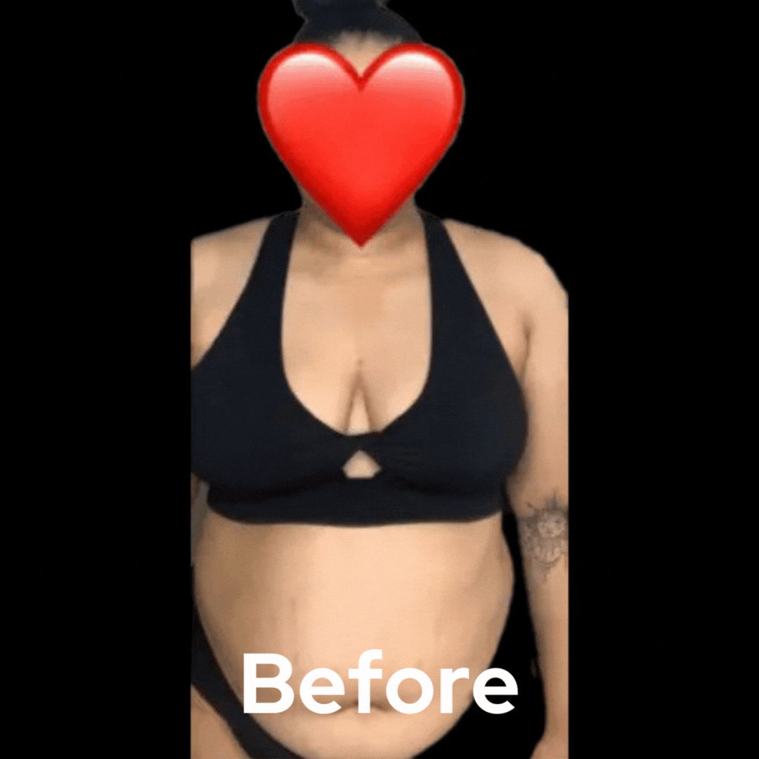 Lipo 360 - Before and After 03