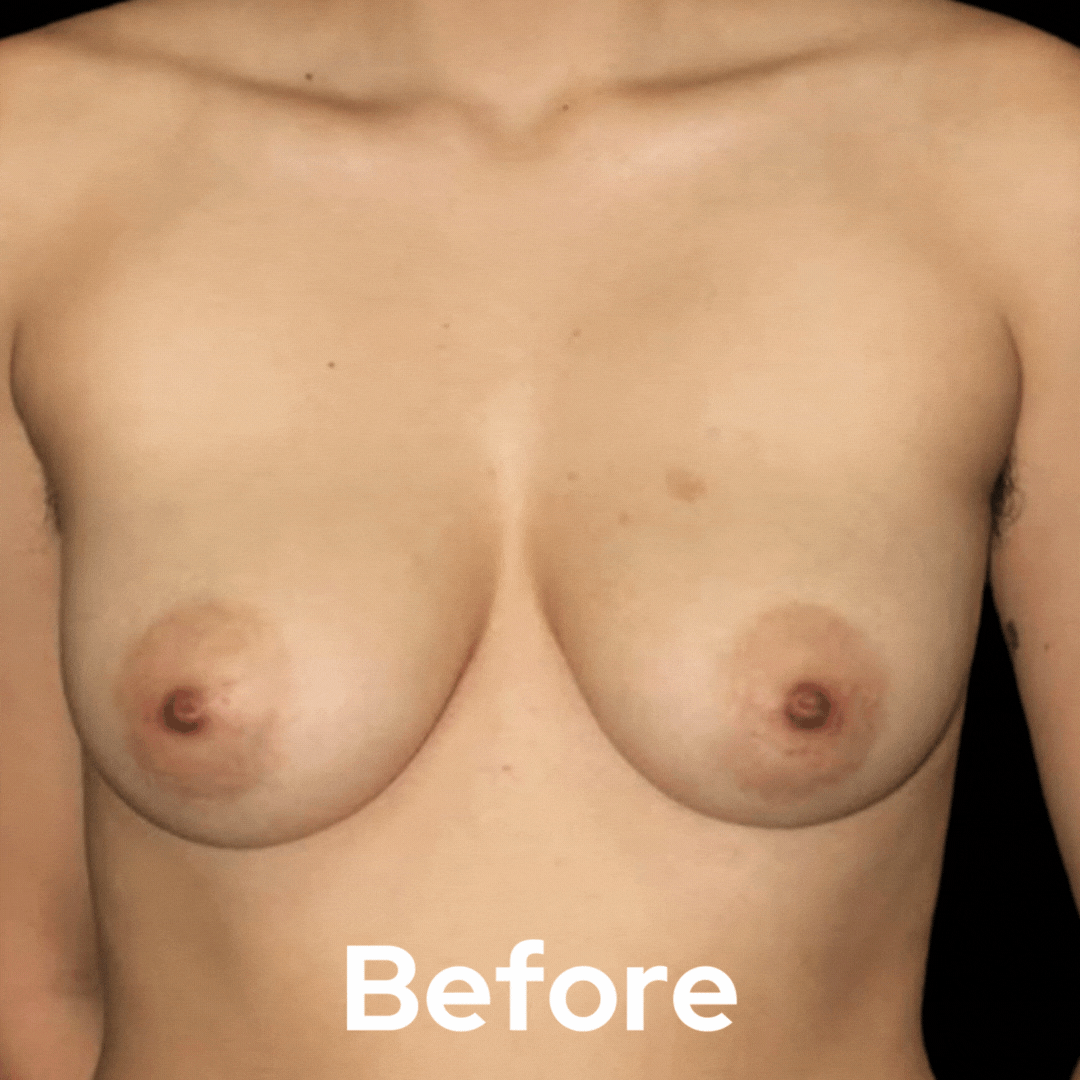 Transgender - Before and After 04