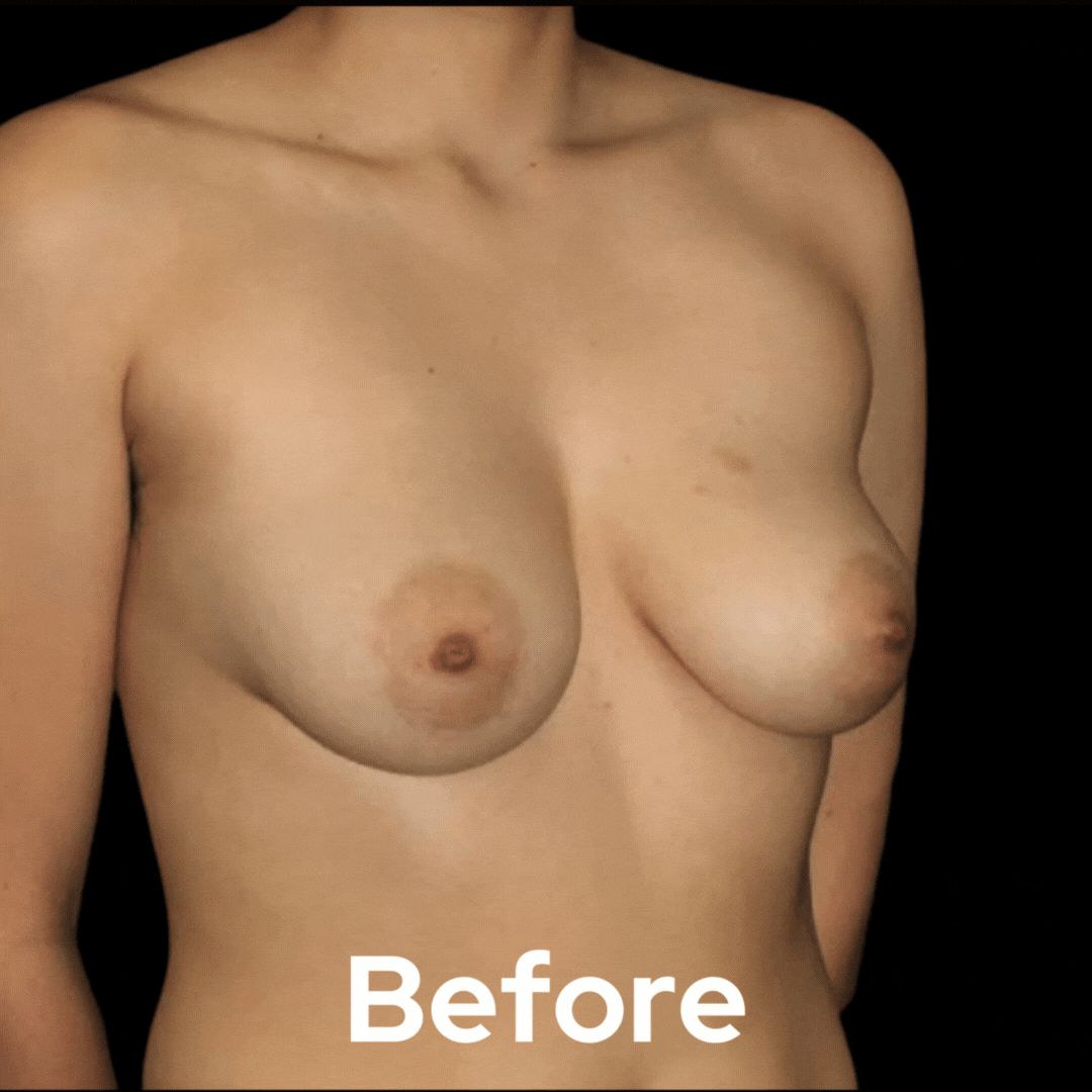 Transgender - Before and After 05