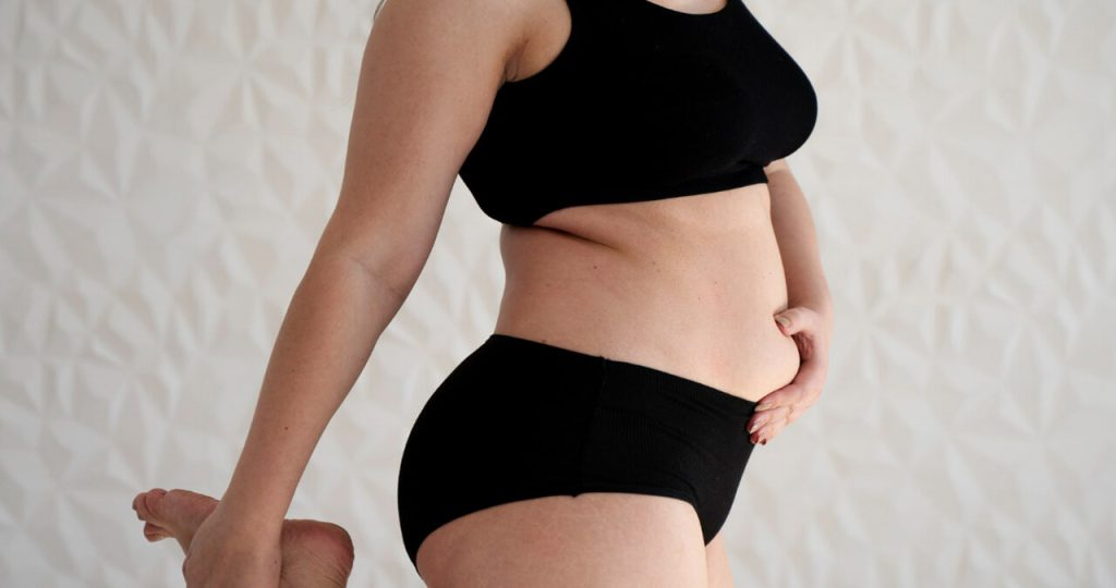 Liposuction vs. Tummy Tuck