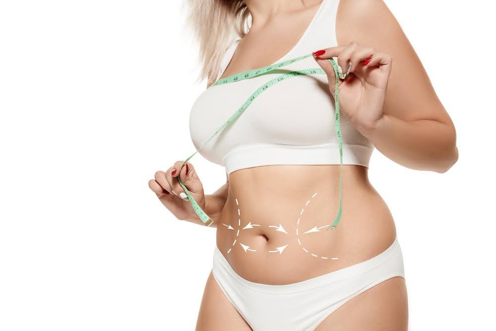 Liposuction vs Tummy Tuck: Key Differences Explained
